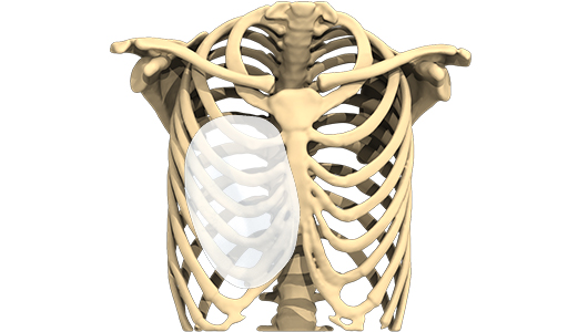 3D-Design des Implantats zur Behandlung der Trichterbrust 3D-Design des Implantats zur Behandlung der Trichterbrust