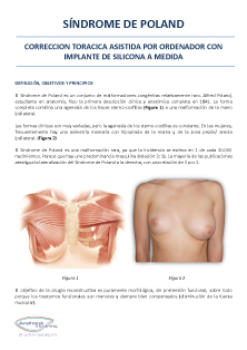 Ficha de informacion Pectus Excavatum
