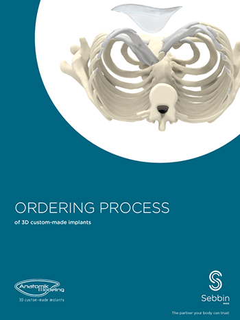 Thoracic implants 3D process