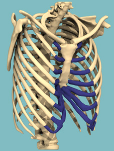 Trichterbrust 3D Design