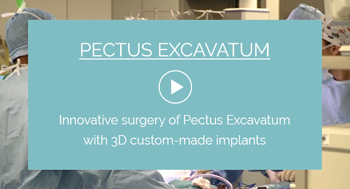 Pectus Excavatum surgery with implant technique video