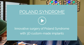 Poland Syndrome surgery with implant technique video
