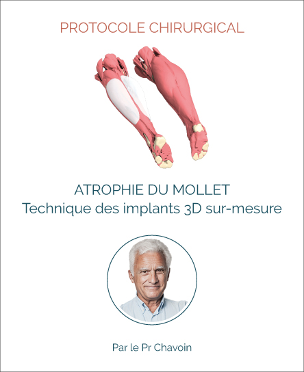 Protocole chirugie atrophie des mollets avec implants
