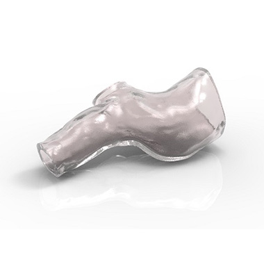 Der weltweit erste maßgeschneiderte 3D-Atemwegstent