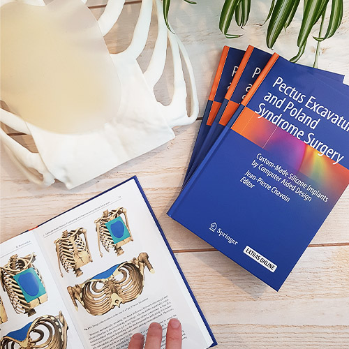 Springerbuch Veröffentlichung: Pectus Excavatum and Poland Syndrome Surgery 