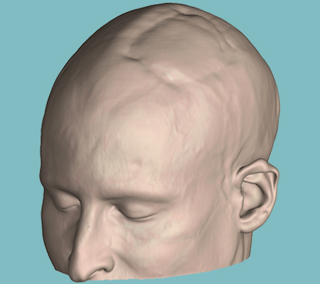 Tête 3D pour créer design d'implant