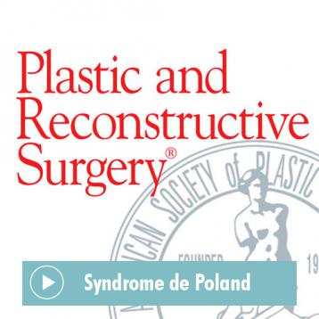 PRS Correction du Syndrome de Poland Article du Plastic and Reconstructive Surgery Journal sur le Syndrome de Poland